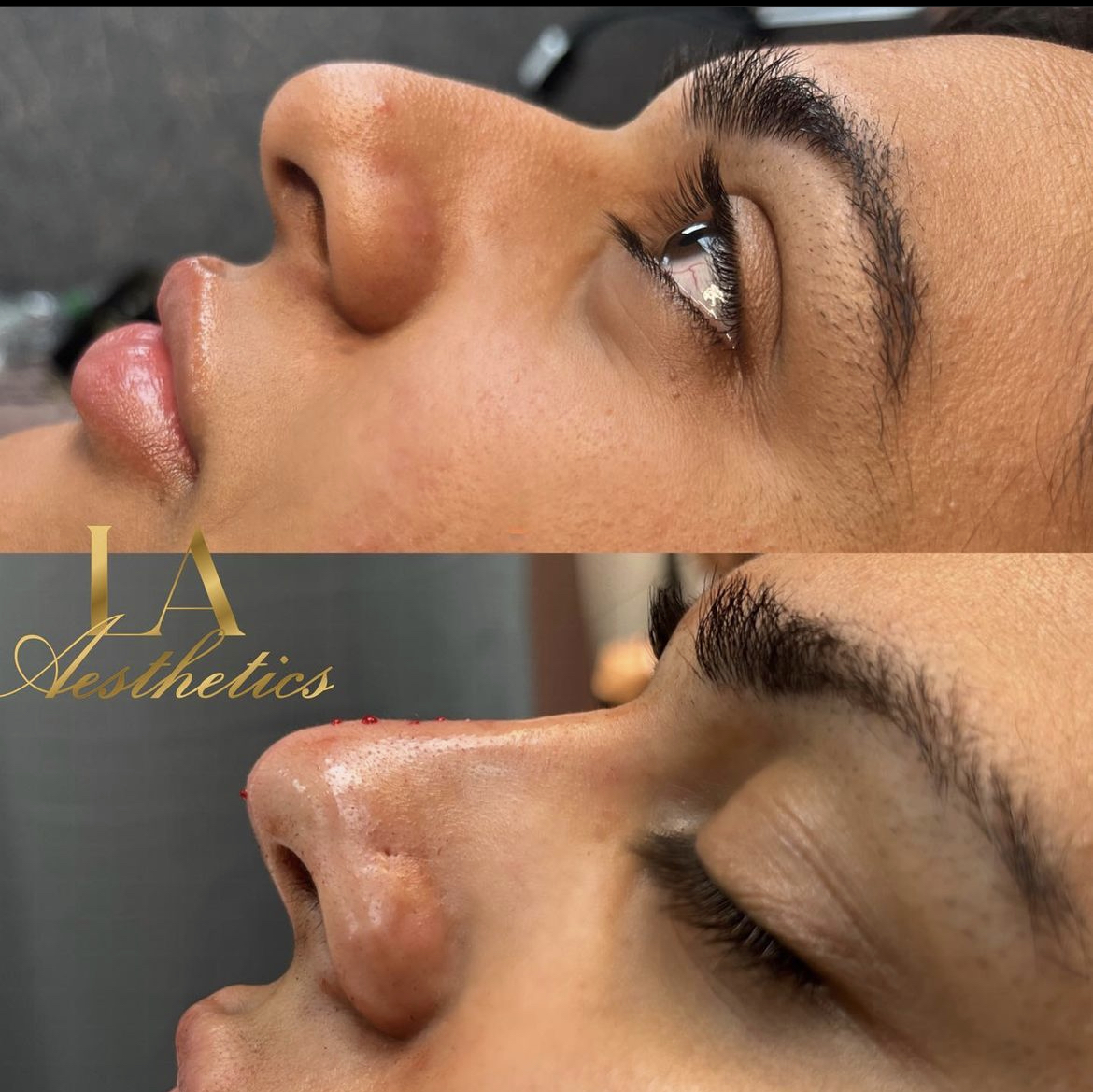 LA Aesthetics | Aesthetic Clinic & Cosmetic Courses In London gallery image 15