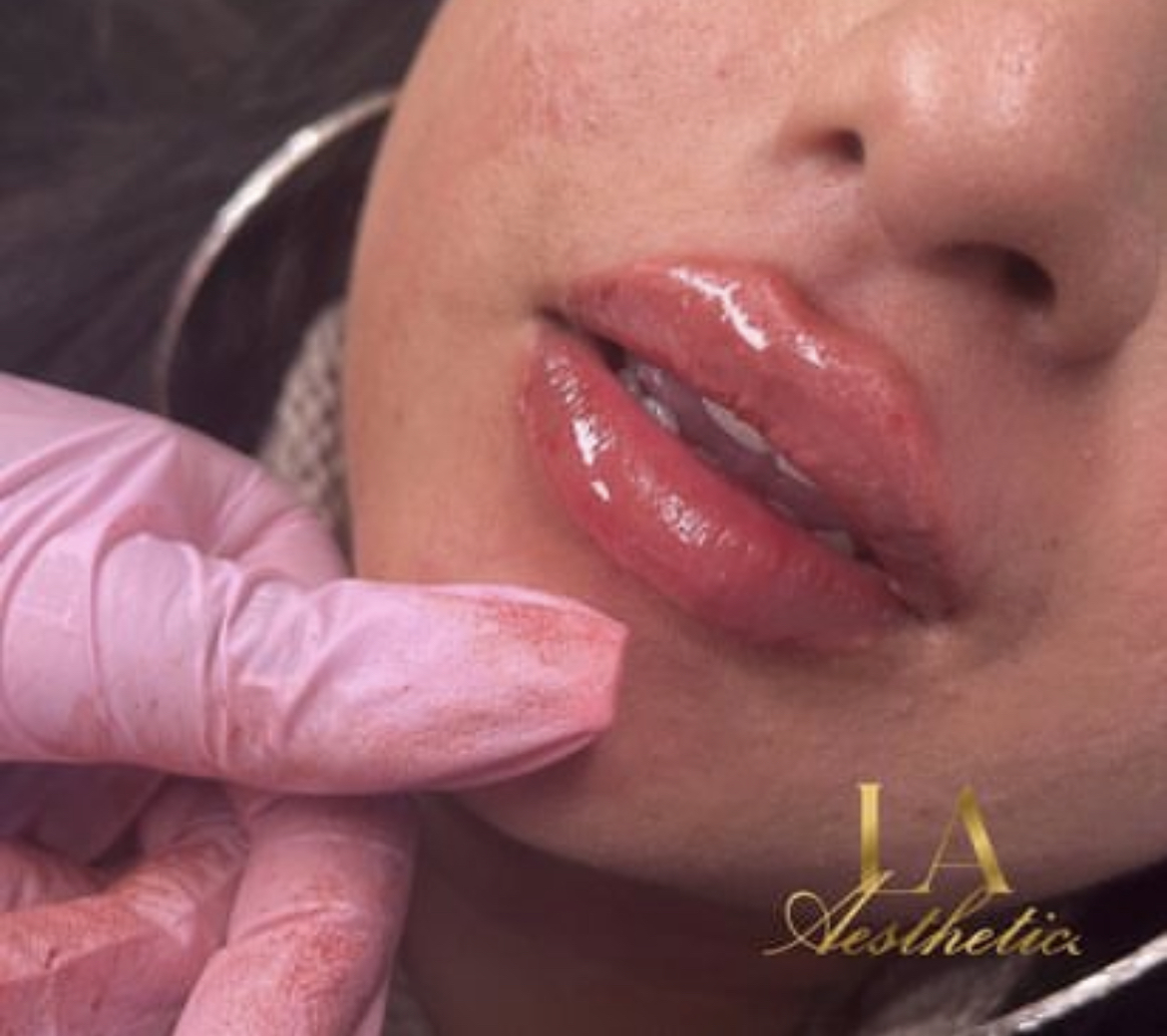 LA Aesthetics | Non-surgical cosmetics | London and Essex gallery image 20