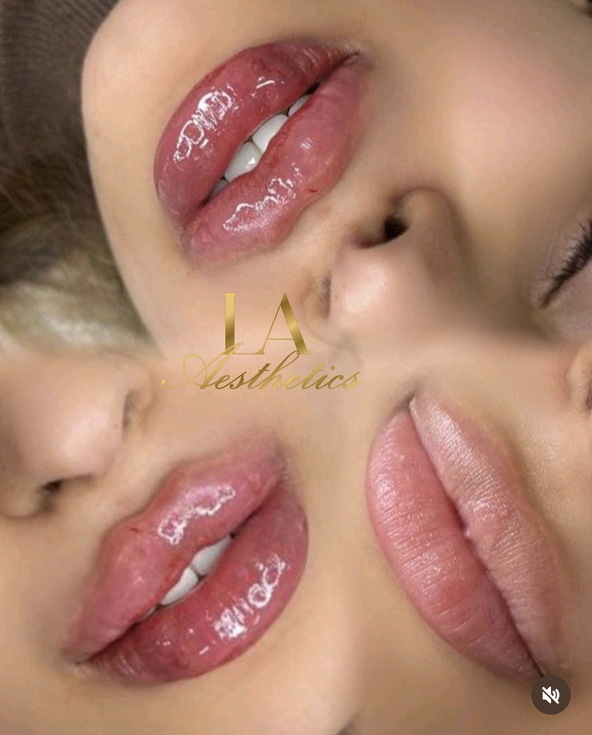 LA Aesthetics | Aesthetic Clinic & Cosmetic Courses In London gallery image 7